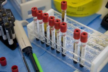 Ambulatori distrettuali  ASL VC